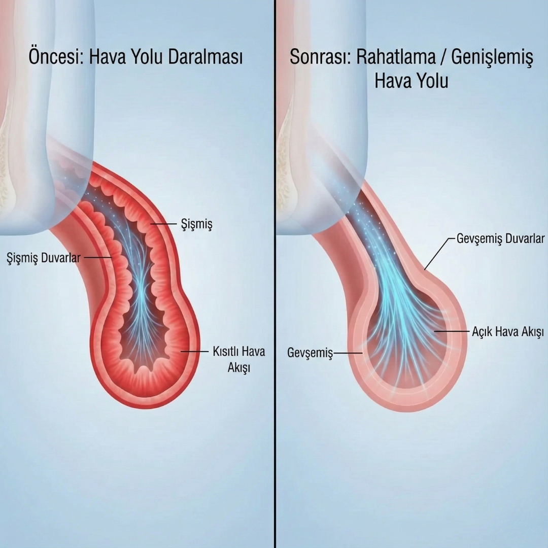 Vezona Care Taşınabilir Mini Nebülizatör